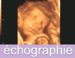 l'echographie